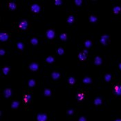 Fluorescent microscope image of Drosophila Kc167 cells treated with PR-Set7 RNAi and labeled with DSHB antibody UNC93-5.2.1 (red). PMID: 27131378, Fig. 3A.
